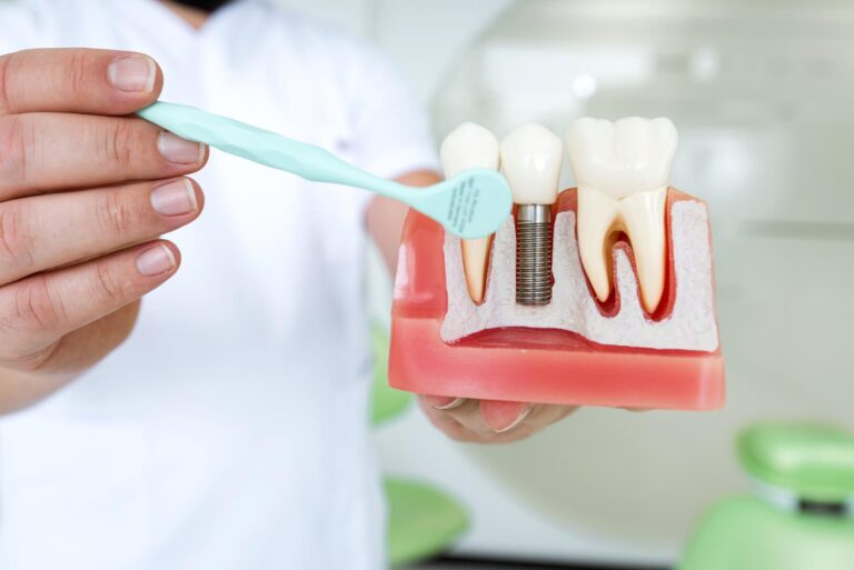 Male Dentist explaining dental implant process